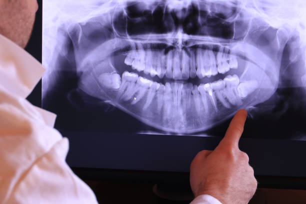 Best Same-Day Emergency Dental Services in Larkspur, CA