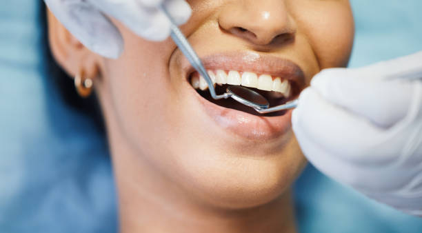 Best Emergency Dental Care for Broken or Chipped Teeth in Larkspur, CA