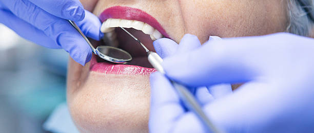Best Emergency Tooth Extraction in Larkspur, CA